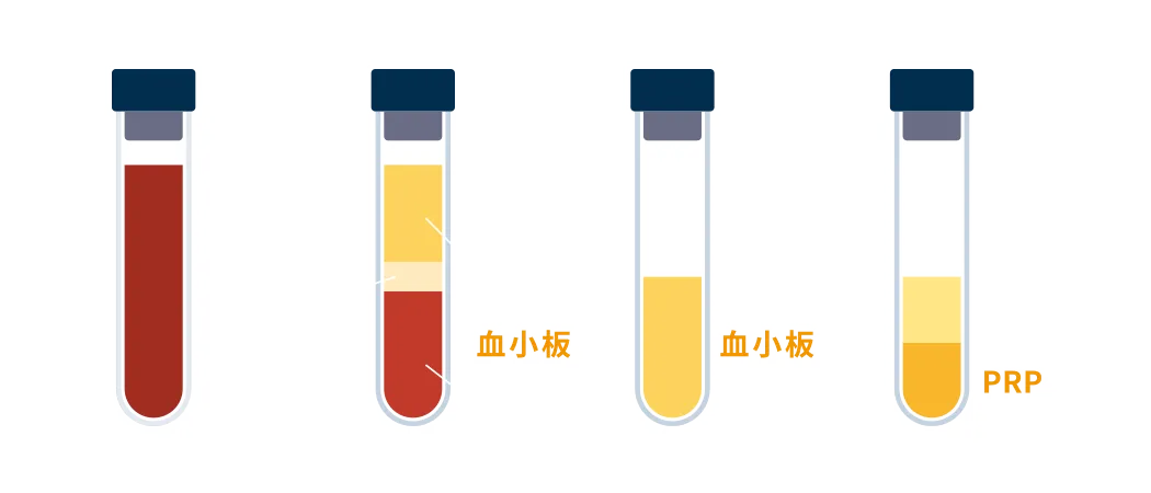 血小板